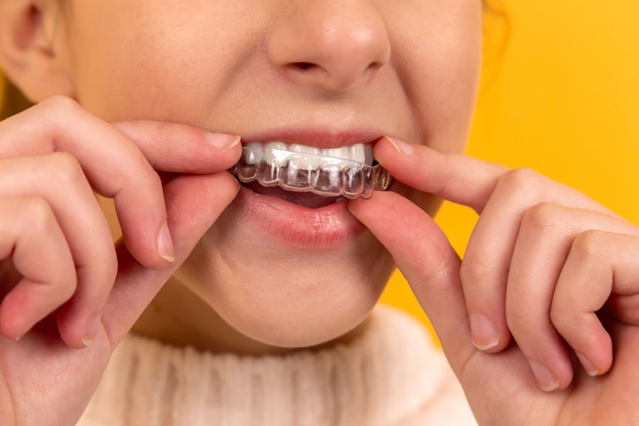 Invisible Braces at Al-SHIFA Dental Clinic